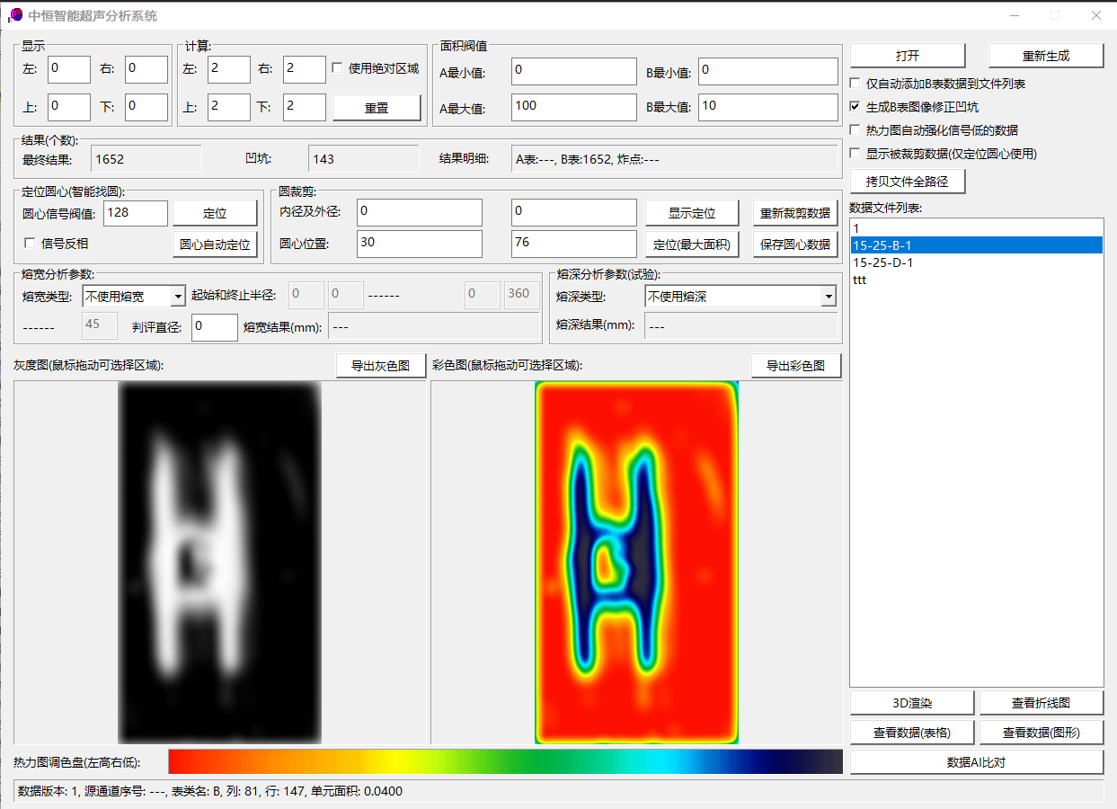 中恒智能超声分析系统界面